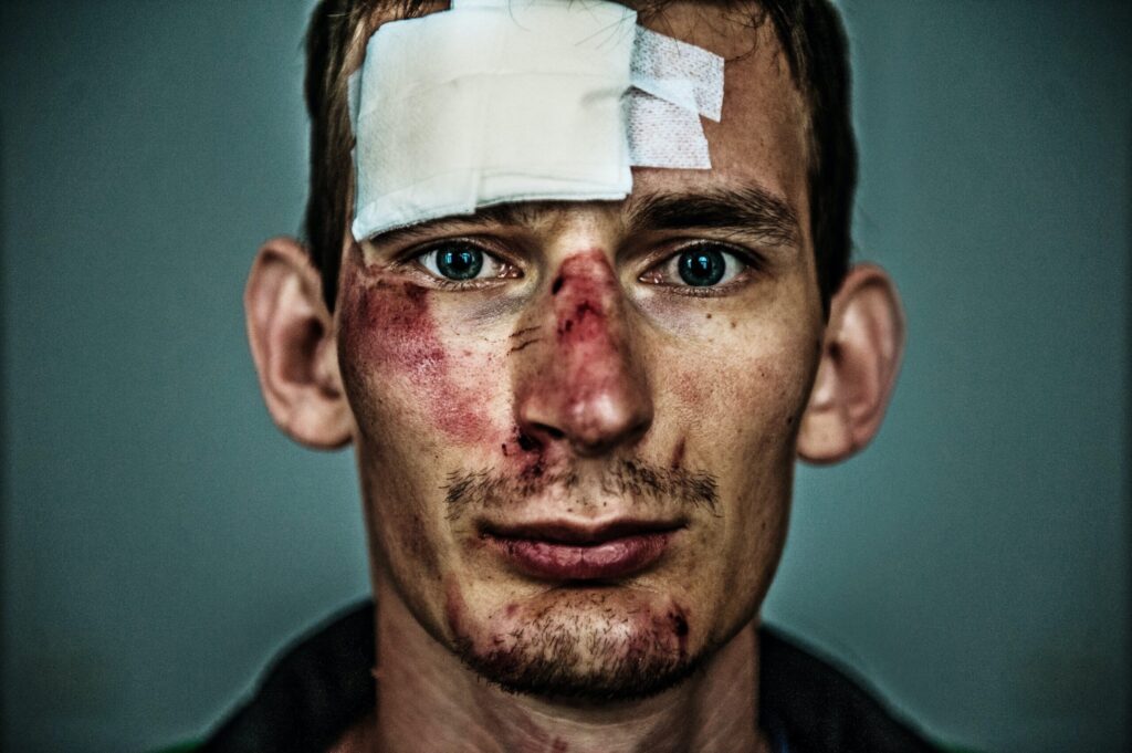injured man's face